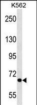 ALS2CR8 Antibody (N-term)