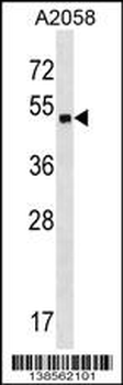 ZNF559 Antibody (Center)