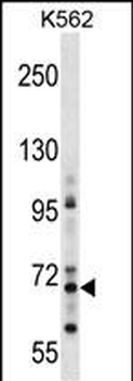 ZNF256 Antibody (Center)