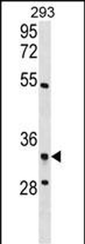 RPF2 Antibody (C-term)
