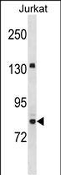 UHRF2 Antibody (Center)