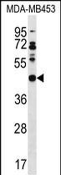 DNAJB5 Antibody (C-term)