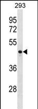 CCNJ Antibody (Center)