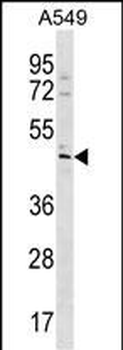 TBC1D20 Antibody (C-term)