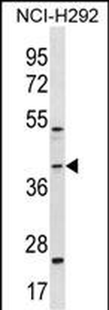 GIPC2 Antibody (C-term)