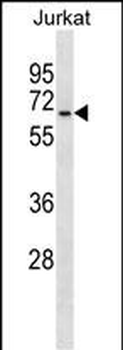 GALNT14 Antibody (N-term)