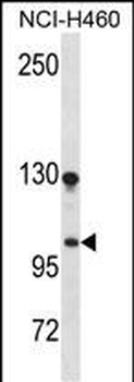 DLGAP3 Antibody (N-term)