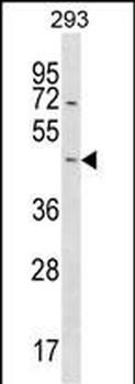 STARD7 Antibody (N-term)