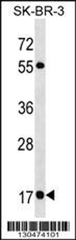 RAB19 Antibody (N-term)