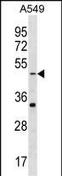 GABRR2 Antibody (N-term)