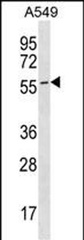 ESAM Antibody (C-term)