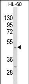 Mouse Kcnj11 Antibody (N-term)