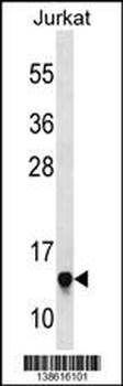 RPS23 Antibody (N-term)