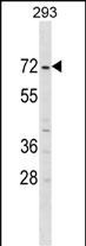ZNF643 Antibody (Center)