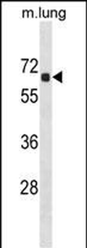 ACOT9 Antibody (Center)