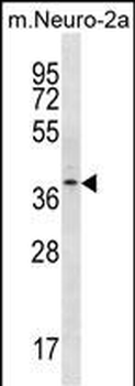 THOC6 Antibody (Center)