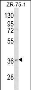 RNF144B Antibody (Center)