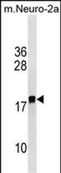 LDOC1L Antibody (C-term)