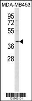 FFAR2 Antibody (C-term)