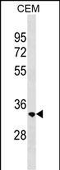RAB40C Antibody (Center)
