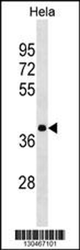 HNRNPA3 Antibody (N-term)