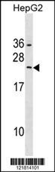 RAB5B Antibody (Center)