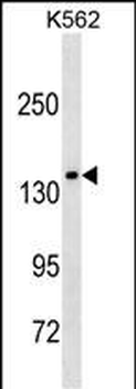MLLT2 Antibody (C-term T1196)