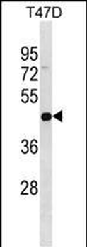 IL22RA2 Antibody (N-term)