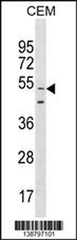 GOLGA6L9 Antibody (N-term)