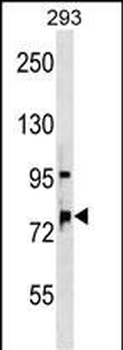 OSBPL11 Antibody (N-term)