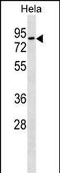 RHOT1 Antibody (N-term)