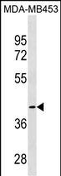 CCBL1 Antibody (C-term)