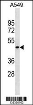 PGLYRP4 Antibody (Center)
