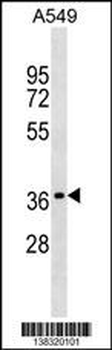 OR2W1 Antibody (C-term)