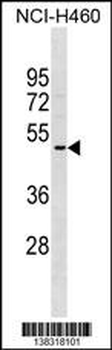 OR2A5 Antibody (C-term)