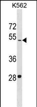 LDHAL6B Antibody (N-term)