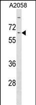 KLHL14 Antibody (Center)