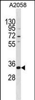 TGIF2LX Antibody (Center)