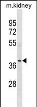 POC1A Antibody (N-term)