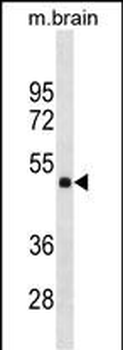 HMBOX1 Antibody (Center)