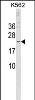 CRYBB3 Antibody (C-term)
