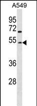 GCNT2 Antibody (Center)