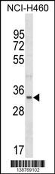 FBLL1 Antibody (Center)