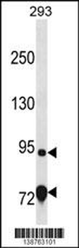 EXD3 Antibody (Center)