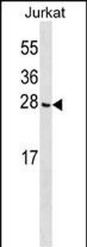 CGGBP1 Antibody (C-term)