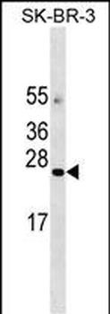 AGTRAP Antibody (C-term)