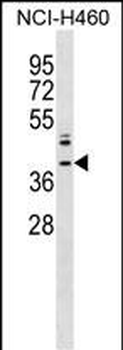 ZNF75A Antibody (Center)