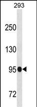 SFMBT1 Antibody (N-term)