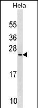 PRELID1 Antibody (N-term)