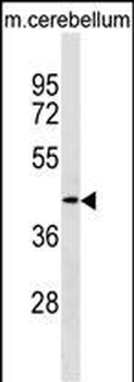 TMOD2 Antibody (N-term)